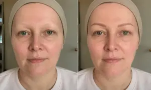 Porównanie twarzy przed i po odzyskaniu brwi po chemioterapii.