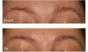 Przed i po makijażu permanentnym brwi. Henna podkreśla efekt, nadając im naturalny wygląd.