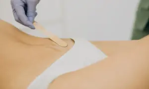 Rękawiczka z woskiem na skórze, zbliżenie na okolice bikini. Zastanawiasz się nad przeciwwskazania do depilacji woskiem?