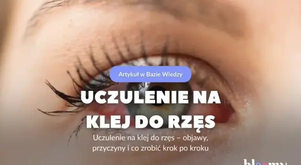 Zbliżenie na oko z przedłużonymi rzęsami, widoczne zaczerwienienie i tekst o uczuleniu na klej.
